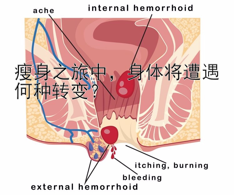 瘦身之旅中，身體將遭遇何種轉(zhuǎn)變？