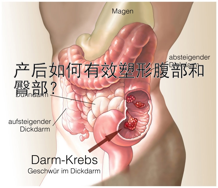 產(chǎn)后如何有效塑形腹部和臀部？