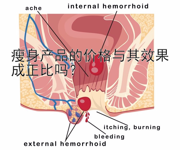 瘦身產(chǎn)品的價格與其效果成正比嗎？