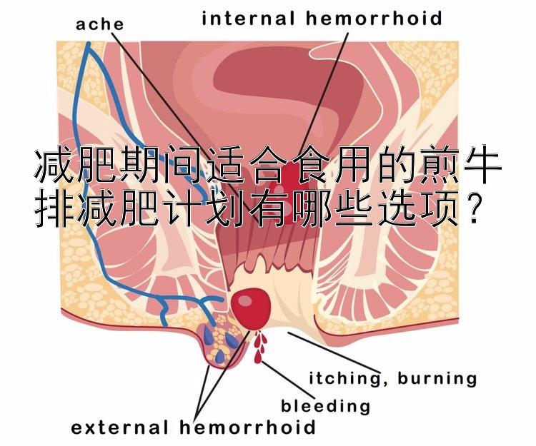 減肥期間適合食用的煎牛排減肥計(jì)劃有哪些選項(xiàng)？