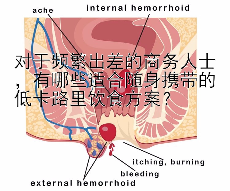 對于頻繁出差的商務(wù)人士，有哪些適合隨身攜帶的低卡路里飲食方案？