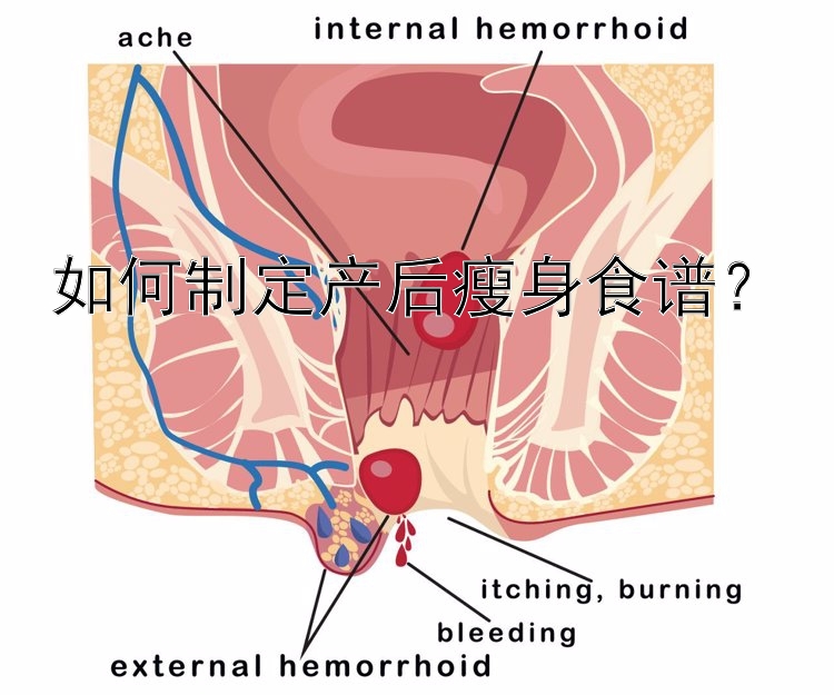 如何制定產(chǎn)后瘦身食譜？