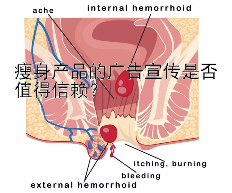 瘦身產(chǎn)品的廣告宣傳是否值得信賴？