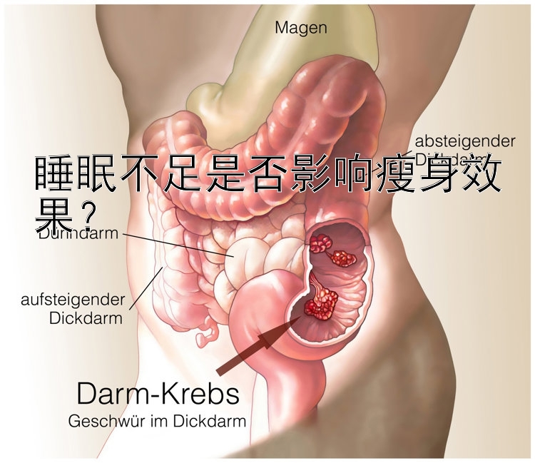 睡眠不足是否影響瘦身效果？