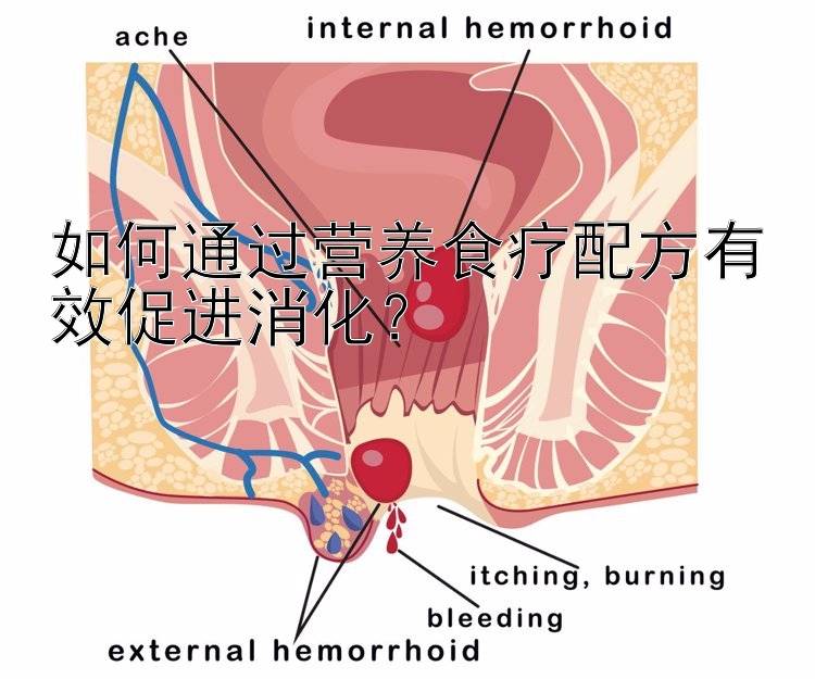 如何通過營養(yǎng)食療配方有效促進(jìn)消化？