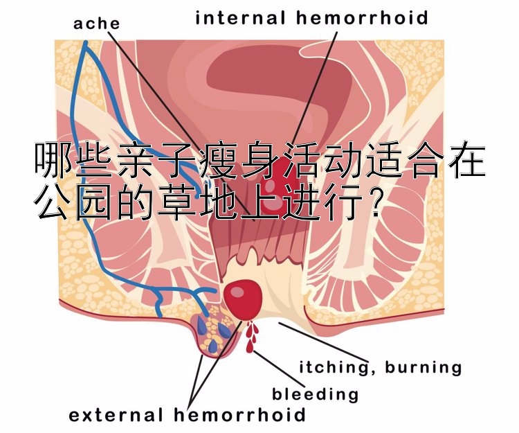 哪些親子瘦身活動(dòng)適合在公園的草地上進(jìn)行？