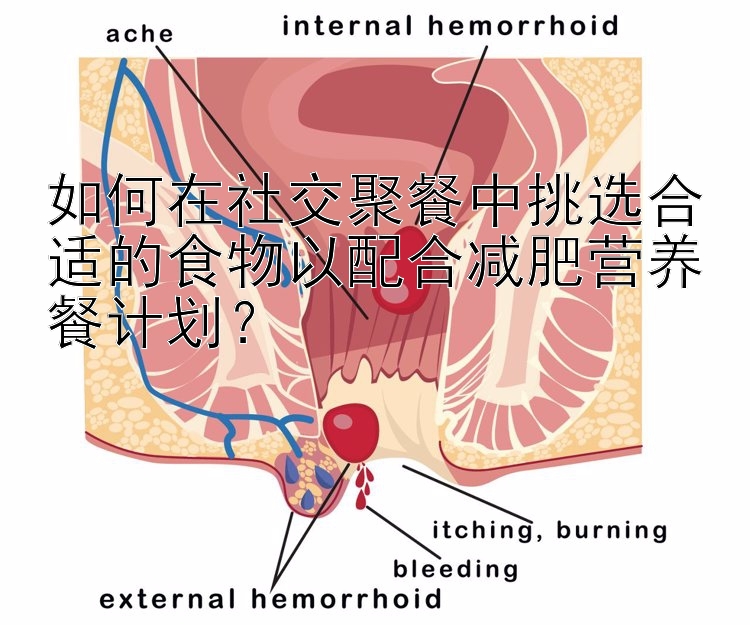 如何在社交聚餐中挑選合適的食物以配合減肥營(yíng)養(yǎng)餐計(jì)劃？