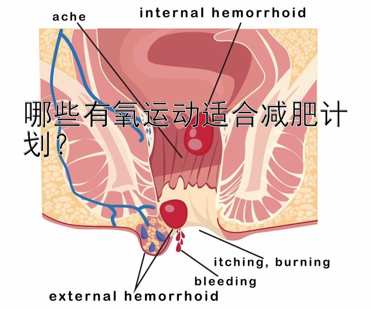 哪些有氧運(yùn)動(dòng)適合減肥計(jì)劃？