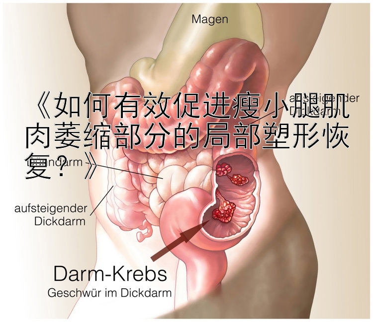 《如何有效促進(jìn)瘦小腿肌肉萎縮部分的局部塑形恢復(fù)？》