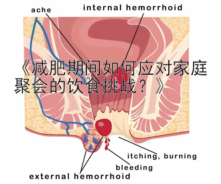 《減肥期間如何應(yīng)對(duì)家庭聚會(huì)的飲食挑戰(zhàn)？》