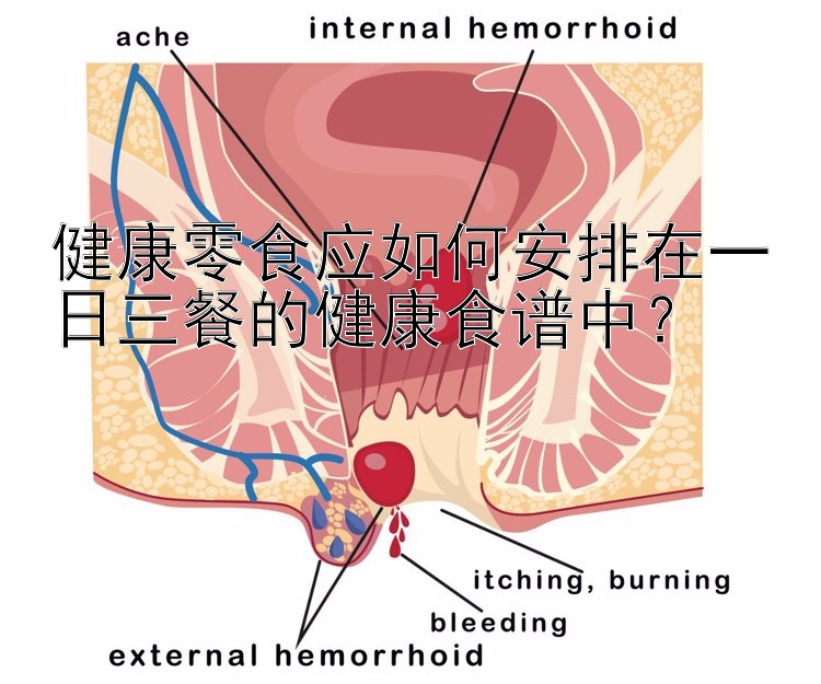 健康零食應(yīng)如何安排在一日三餐的健康食譜中？