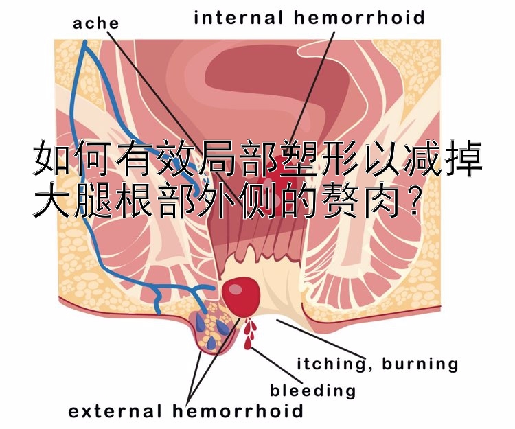 如何有效局部塑形以減掉大腿根部外側(cè)的贅肉？