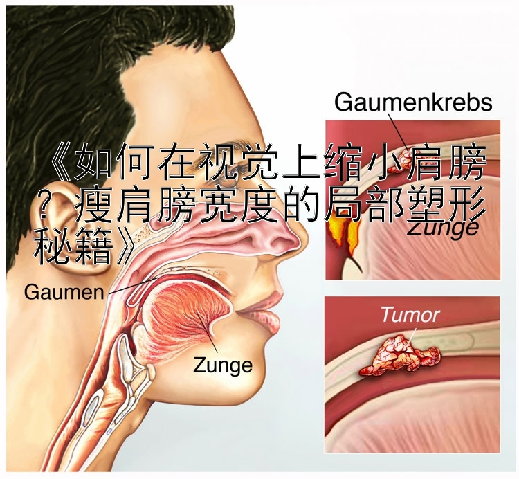 《如何在視覺上縮小肩膀？瘦肩膀?qū)挾鹊木植克苄蚊丶? loading=