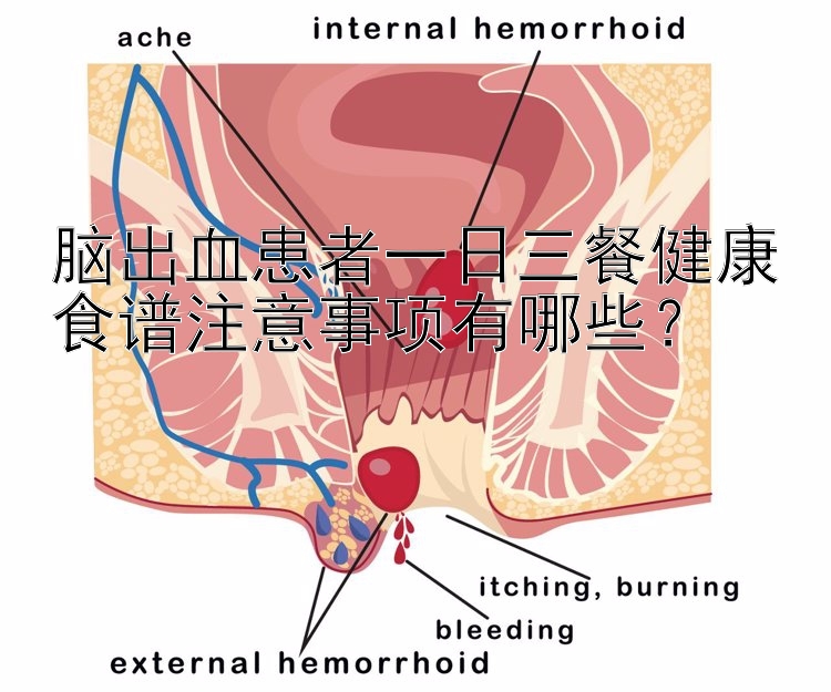 腦出血患者一日三餐健康食譜注意事項有哪些？